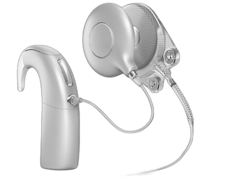 Neuro System hearing implant by Oticon Medical